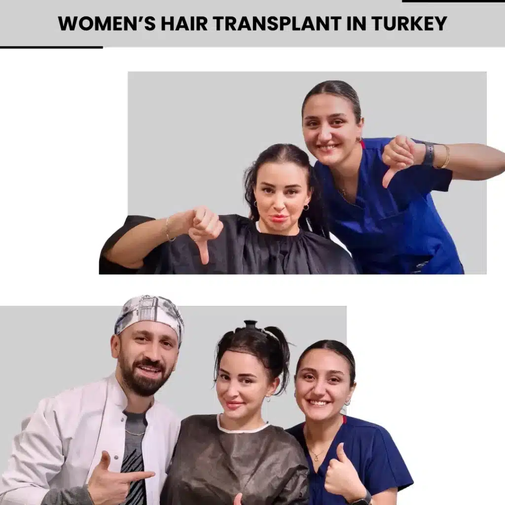 Hair Transplant For Women 15 Hair Transplant Techniques Used For Female
