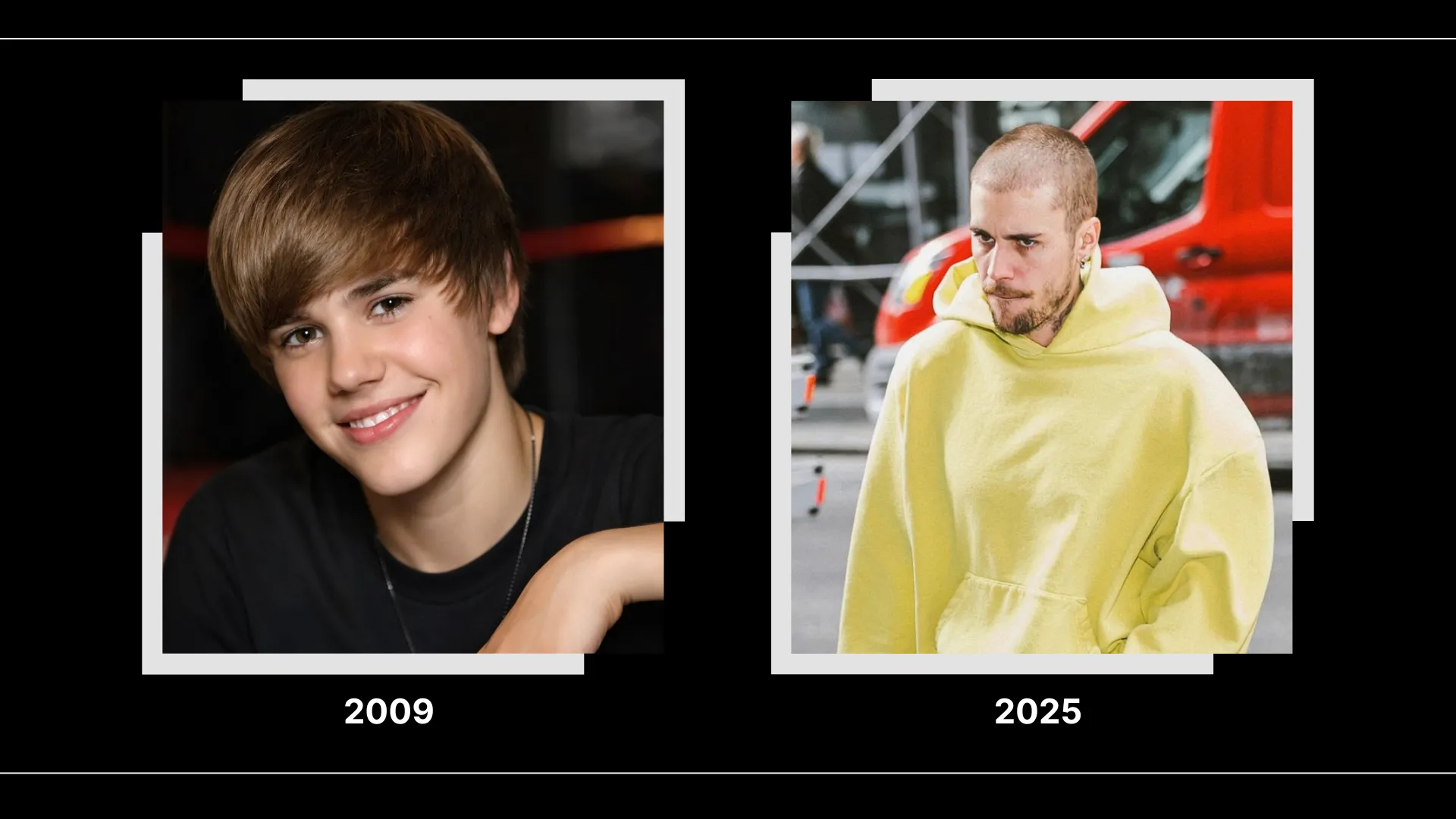 Justin Bieber Hair Transplant: Hairline Analysis, Before &Amp; After Photos, Rumors &Amp; Expert Opinion 10 Justin Bieber 2009 And 2025 Hairline Comparison Showing Visible Hairstyle And Frontal Hair Coverage Changes