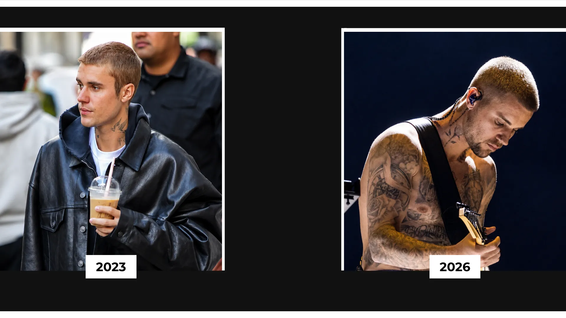 Justin Bieber Hair Transplant: Hairline Analysis, Before &Amp; After Photos, Rumors &Amp; Expert Opinion 8 Justin Bieber 2023 And 2026 Hairline Comparison Showing Buzz Cut Hairstyle, Frontal Hair Coverage, And Visible Hairline Changes