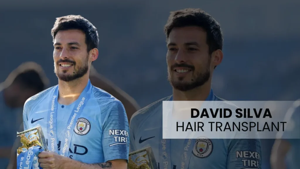 David Silva Hair Transplant Cover Image Featuring Manchester City Midfielder David Silva And Hair Restoration Analysis