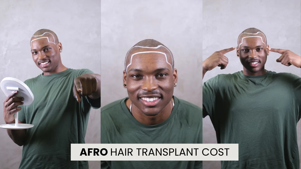 Afro Hair Transplant Cost In Turkey Afro Hair Transplant Cost In Turkey Guide With Afro Hairline Design Consultation