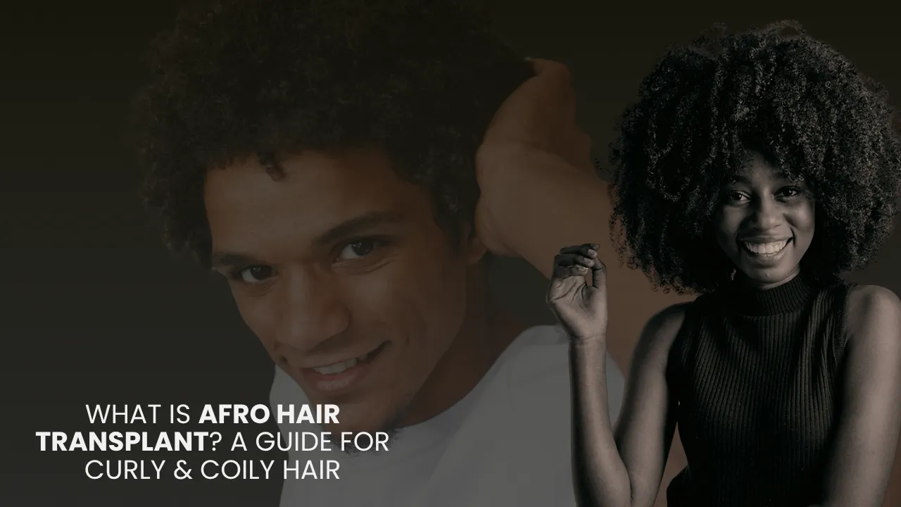 What Is Afro Hair Transplant What Is Afro Hair Transplant? Complete Guide For Curly And Coily Hair Restoration