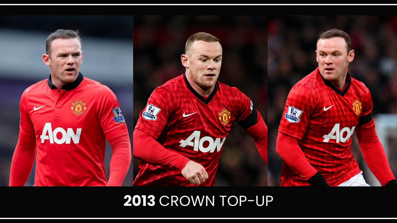 Wayne Rooney Hair Transplant: Before &Amp; After 7 Wayne Rooney 2013 Crown Top-Up Procedure Showing Maintained Hair Density And Continued Hair Restoration Results