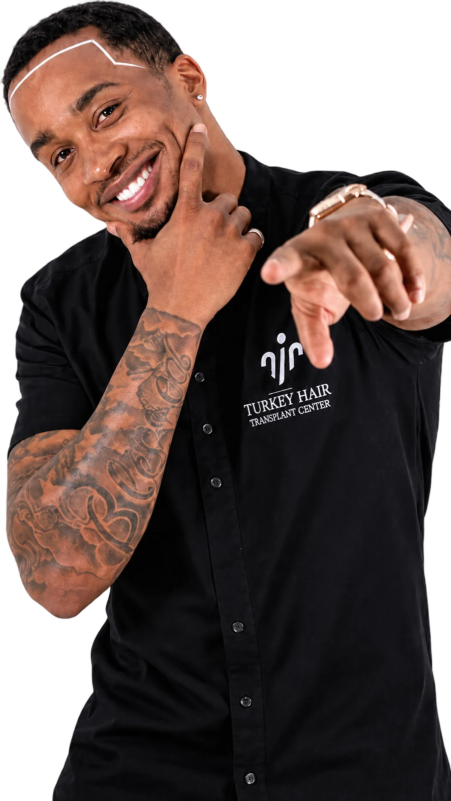 Turkey Hair Center hair transplant patient
