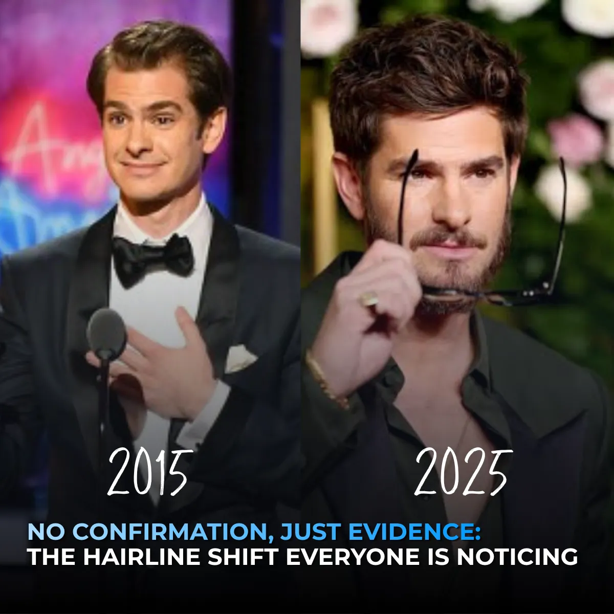 Andrew Garfield Hair Transplant: Did He Get One?