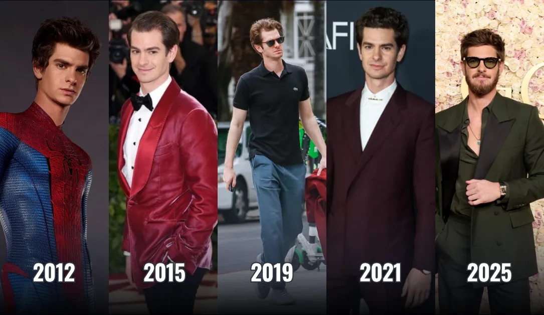 Andrew Garfield Hair Transplant: Did He Get One?