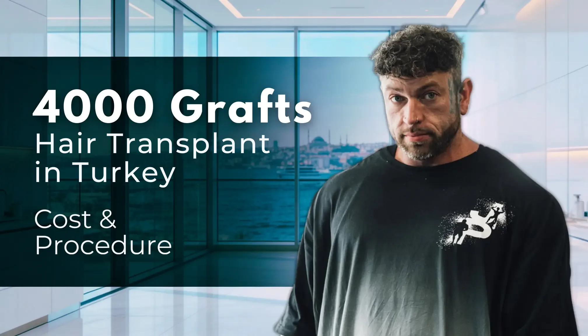 4000 greffons de cheveux en Turquie hair transplant analysis