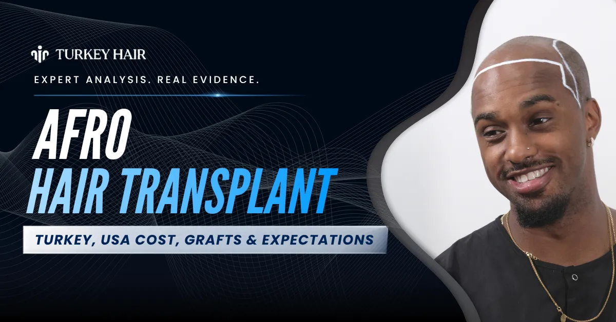 Afro hair transplant, genetic hair thinning, Afro hair loss analysis, curly hair transplant, Afro hair restoration