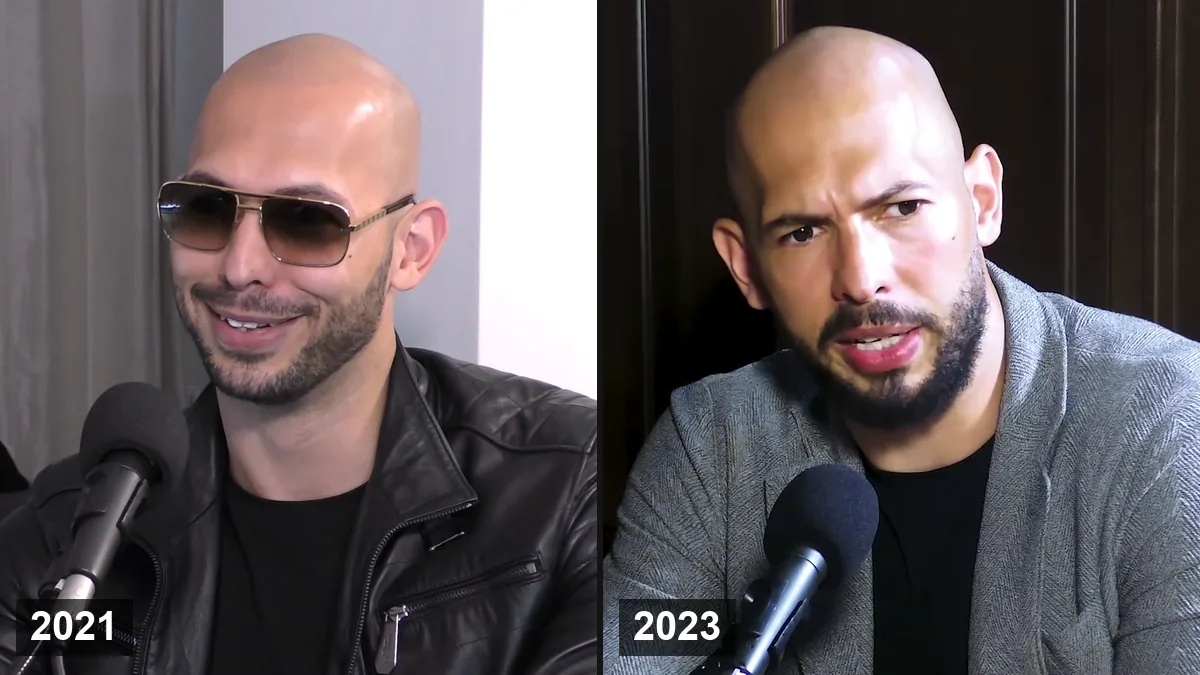 Andrew Tate Greffe de Cheveux: En A-t-il Subi une ou Est-il Chauve par Choix? Hair Transplant hair transplant analysis