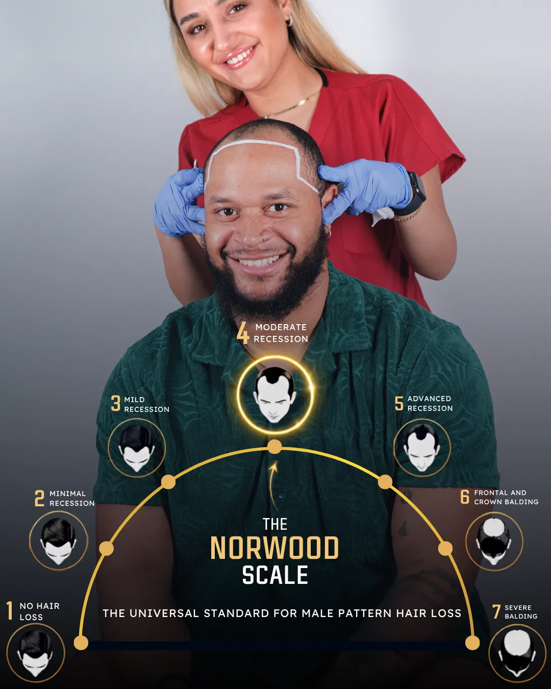 natural DHT blockers, DHT blocker treatment, hair loss supplements, DHT hair loss prevention