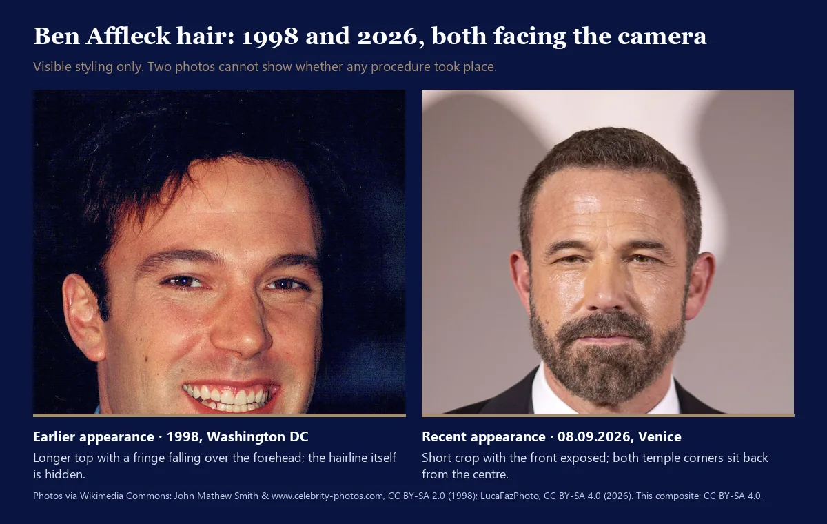 Ben Affleck hair before and after comparison