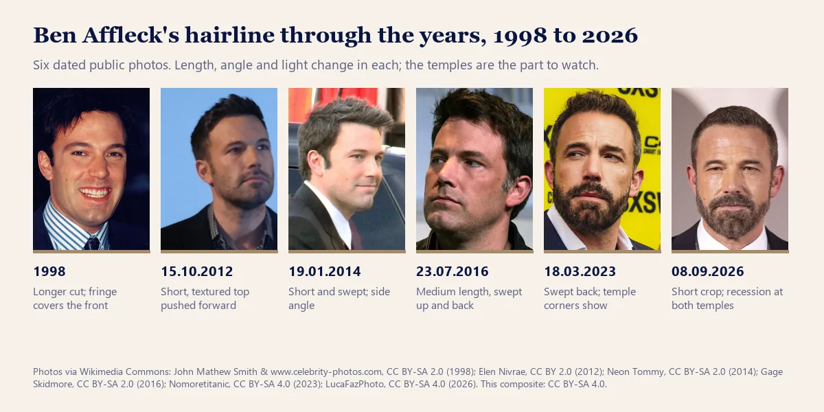Ben Affleck hairline through the years