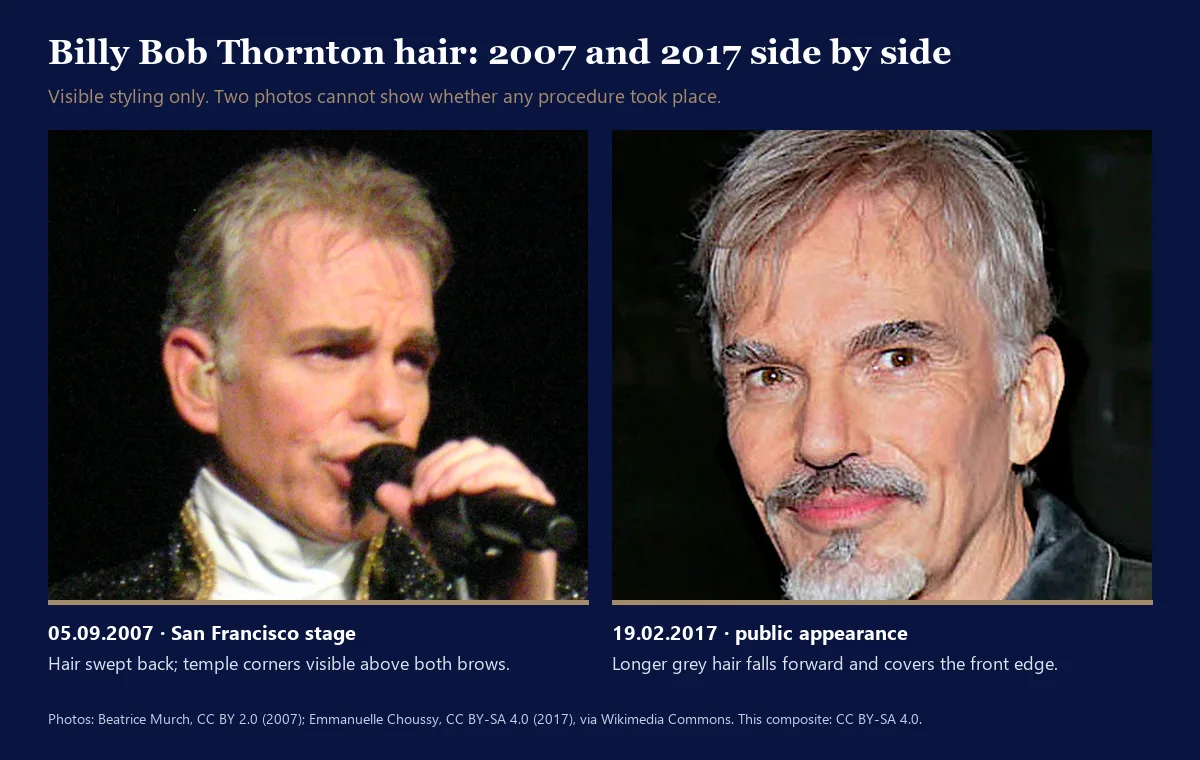 Billy Bob Thornton hair before and after