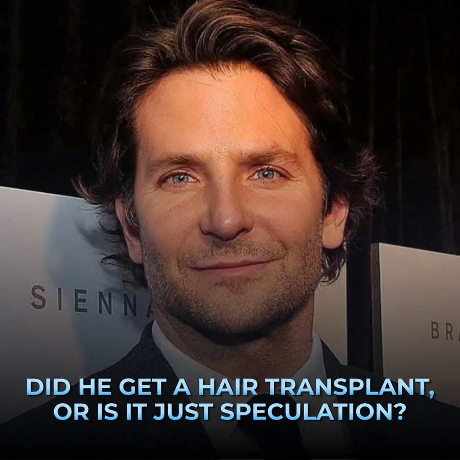 Bradley Cooper at a premiere with a full swept-back hairline, captioned with the question of transplant or speculation