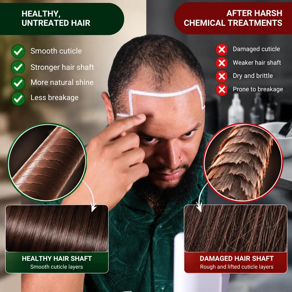 hair transplant results, different hair types, hair transplant hair types