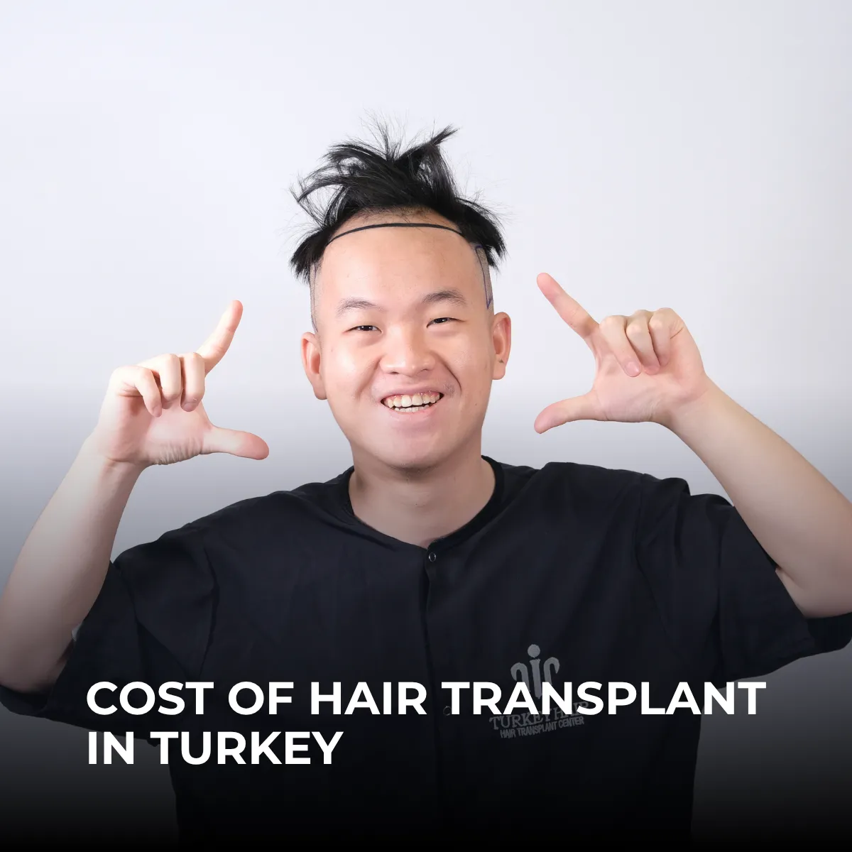 hair transplant cost comparison, hair implants cost, USA vs Turkey hair transplant, hair restoration pricing, hair transplant price guide
