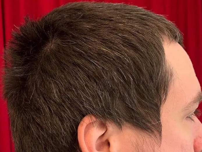 Side view of a man with short brown hair and a tuft standing up at the crown whorl
