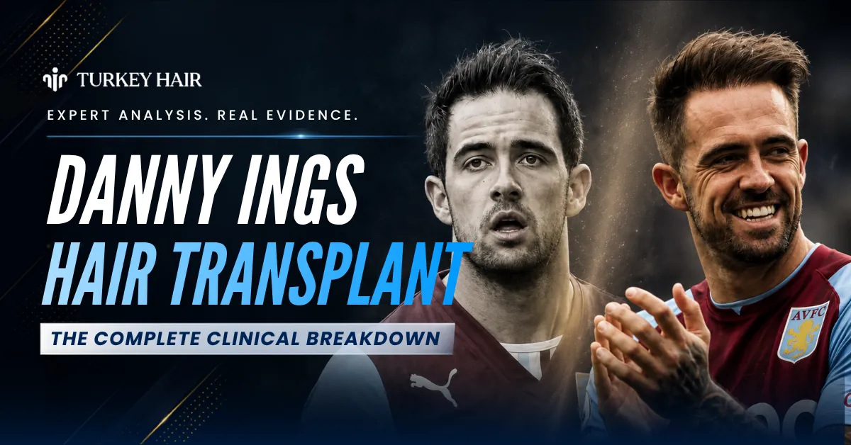 Danny Ings hair transplant, Danny Ings hair restoration, Danny Ings hairline analysis, footballer hair transplant, clinical hair transplant breakdown, Turkey Hair Center