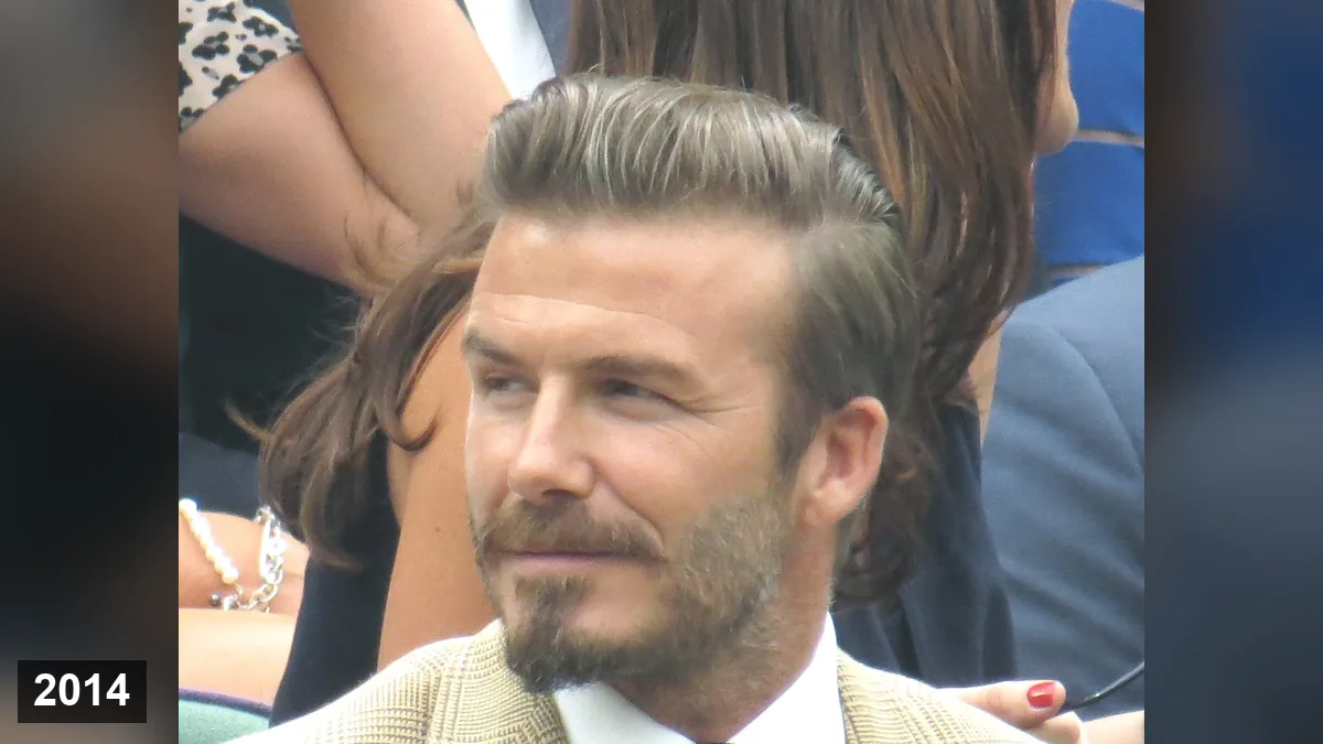 David Beckham: Greffe de cheveux, avant, après, rumeurs et analyse de la restauration capillaire (2026) Hair Transplant hair transplant analysis