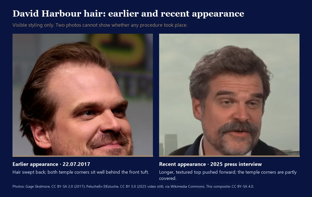 David Harbour hair before and after comparison