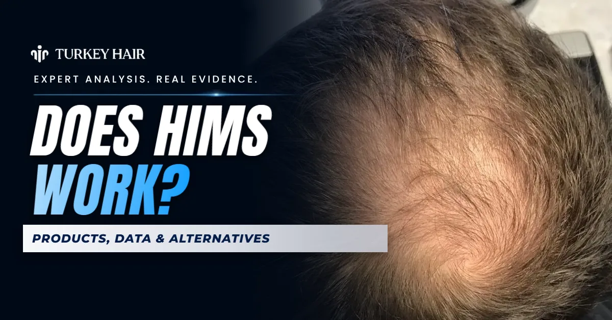 Hims for Hair Loss: Treatment & Comparison hair transplant analysis