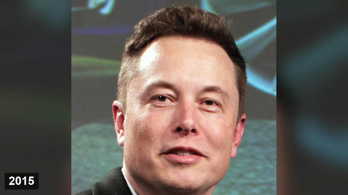 Elon Musk: Analyse de sa greffe de cheveux (FUT & FUE) Hair Transplant hair transplant analysis