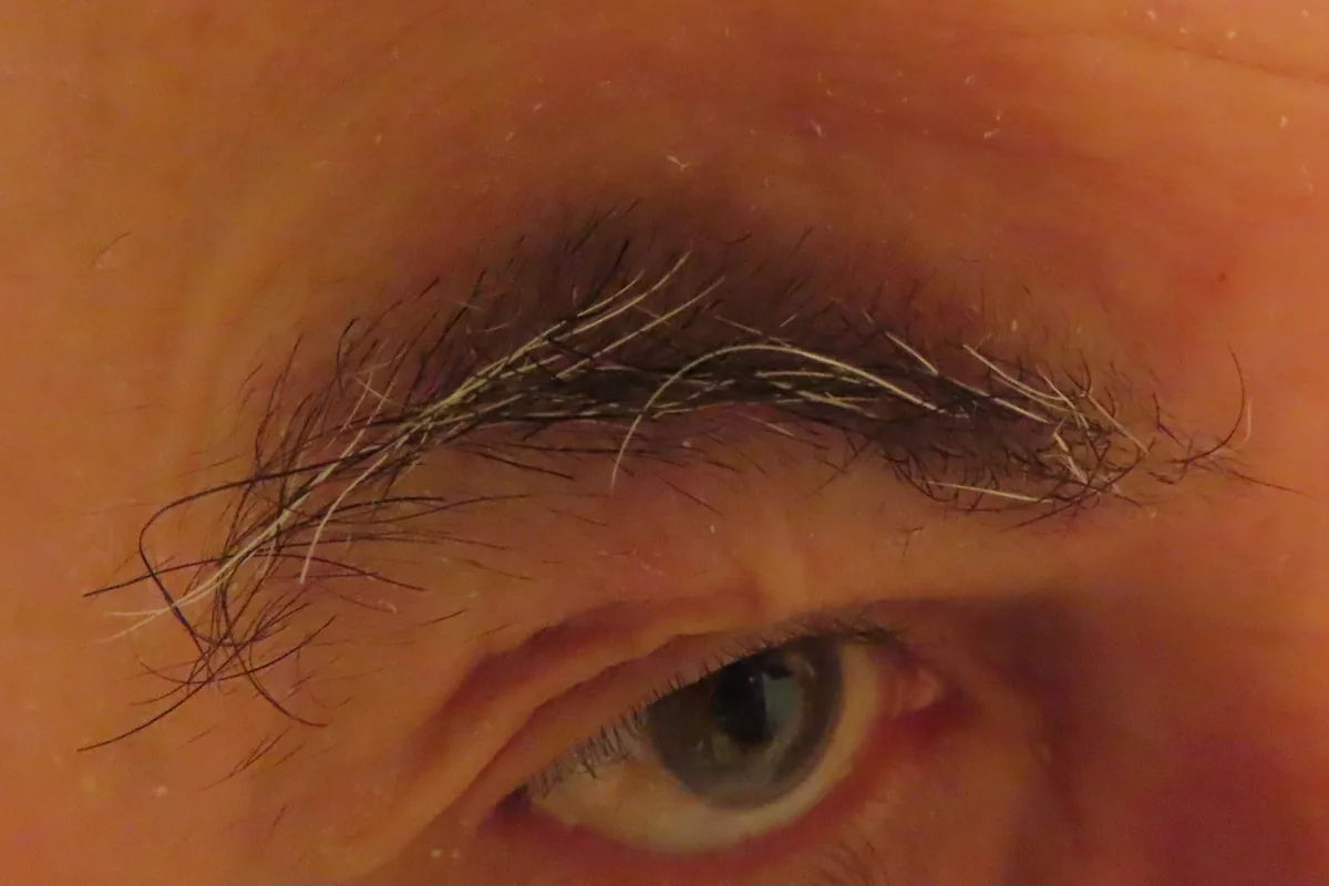 Close-up of an older adult's right eyebrow with long, wiry dark and grey hairs above a lined eyelid