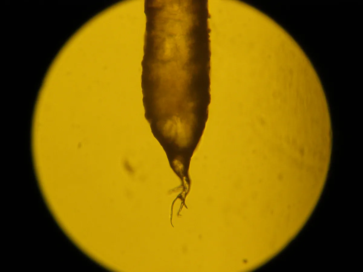 A human black hair root seen under a light microscope, narrowing towards its lower end