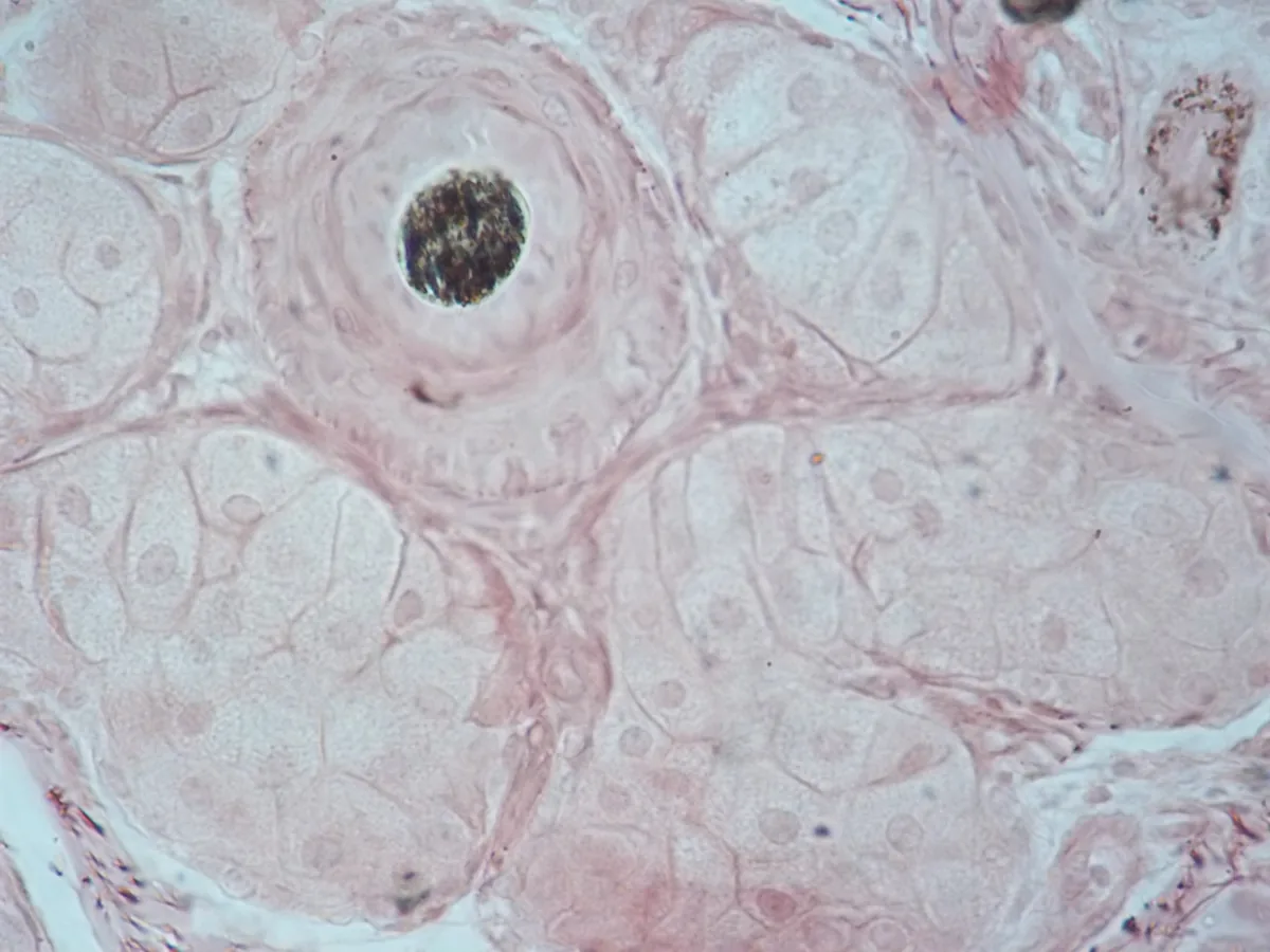 Cross-section of a scalp hair follicle at 400x, with the pigmented hair at the centre ringed by layers of the follicle wall