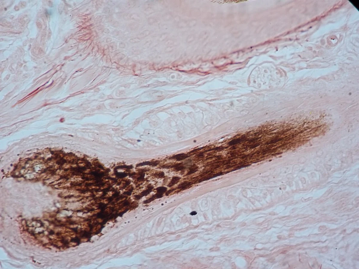 Microscope image of a human scalp hair follicle cut lengthwise, stained pink, with a dark pigmented root