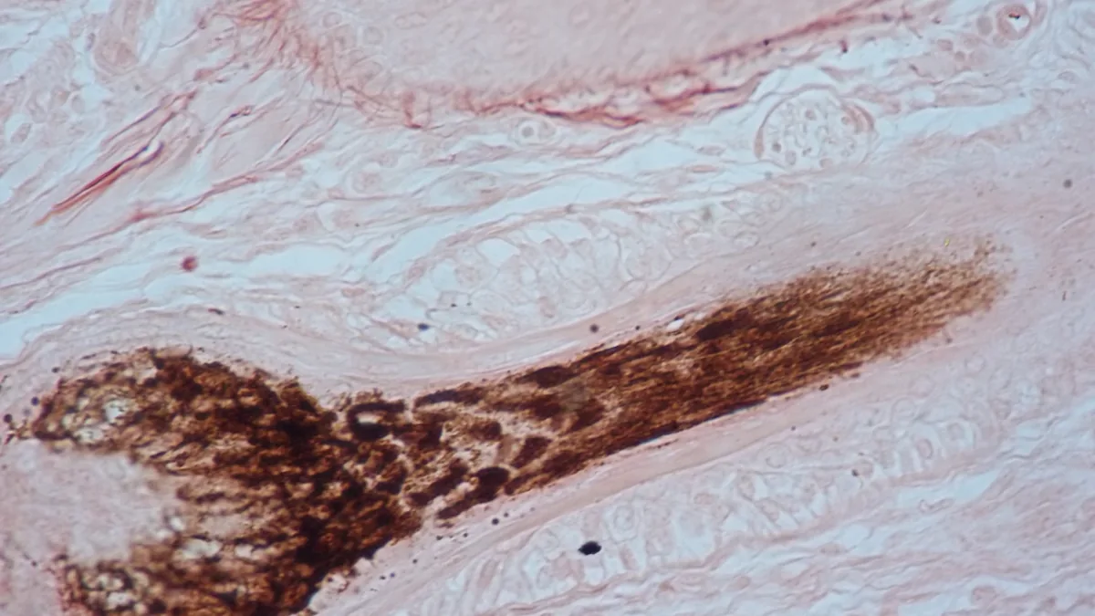 Stained microscope section of skin showing the long dark shaft of a hair follicle running through the tissue