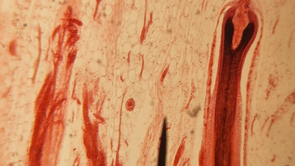 Stained skin section under a microscope with several hair follicles running down through the tissue