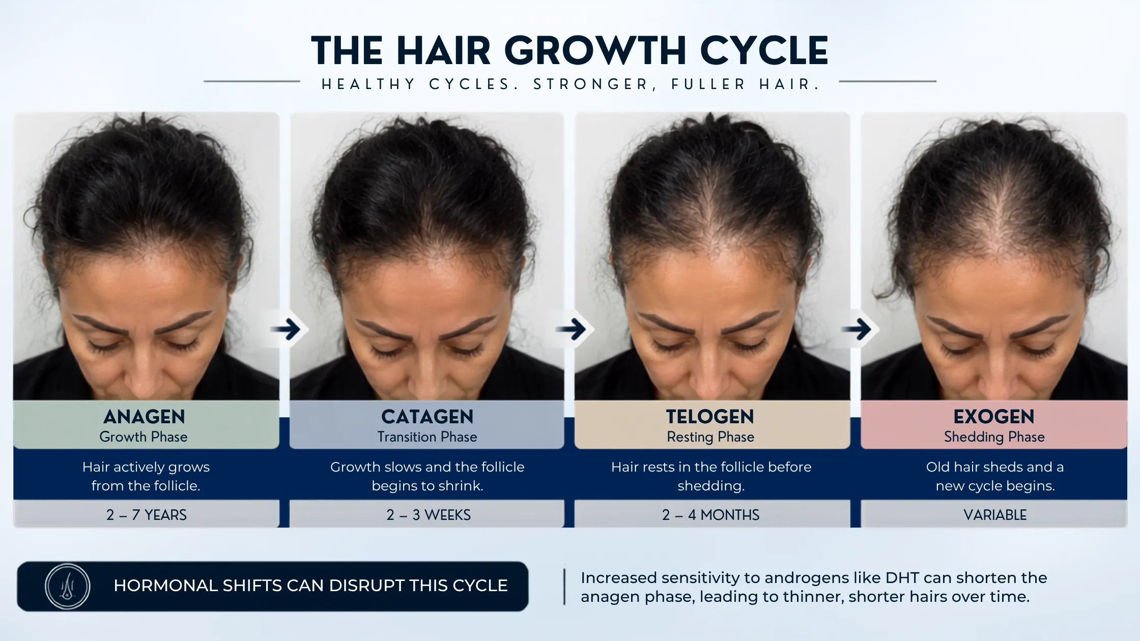 hair loss from birth control, birth control before after, female hair loss results, thinning hair treatment