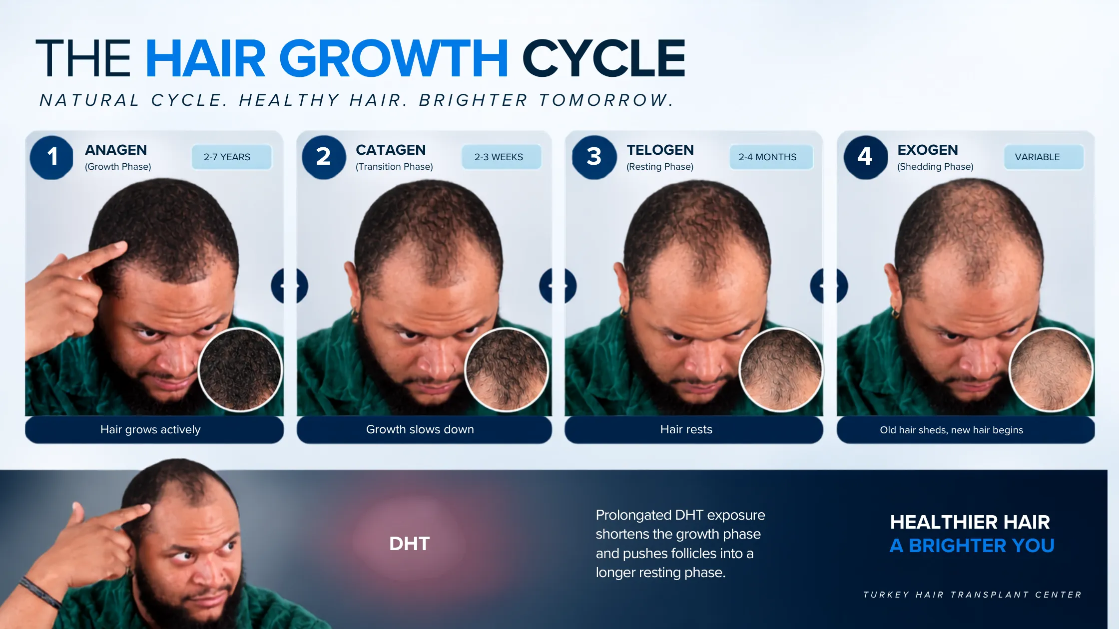 hair growth cycle, DHT hair loss cycle, hair follicle miniaturization, hair regrowth timeline