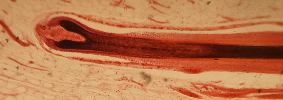 Microscope section of a hair follicle, with the dark pigmented bulb at its base wrapped around the dermal papilla