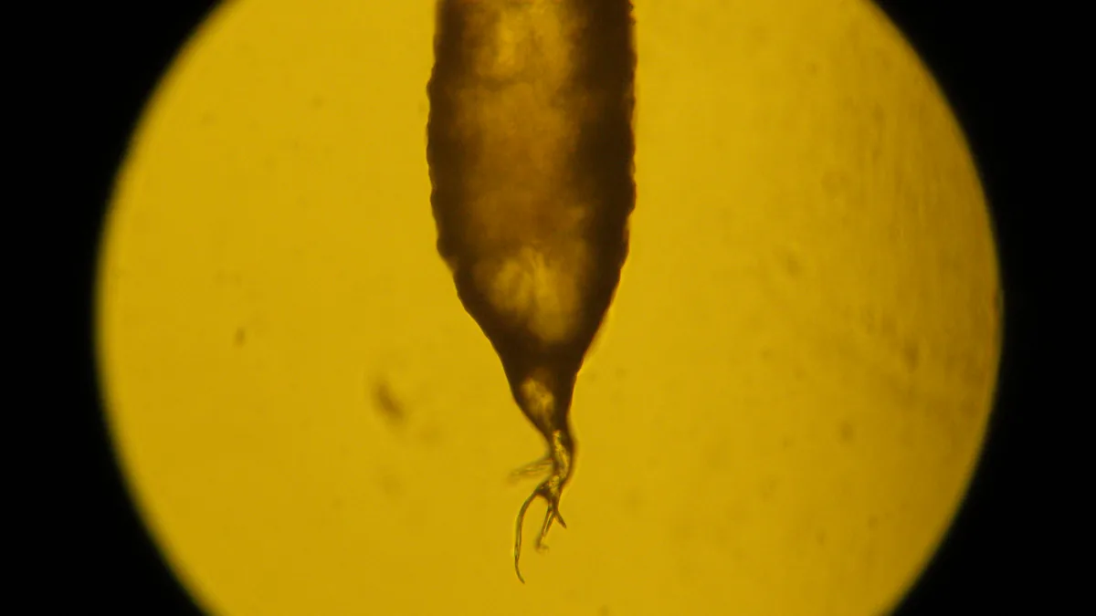 Microscope view of a single human hair with its root bulb at one end