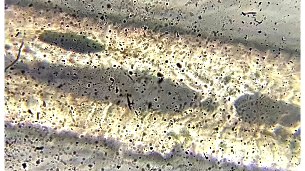 Brightfield micrograph of a grey human hair at 400x, with a darker band running along the centre of the fibre