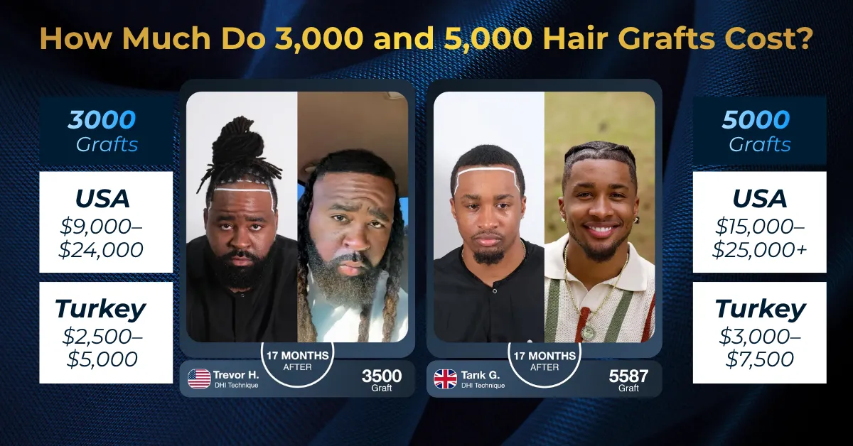 3000 grafts hair transplant cost, 5000 grafts hair transplant cost, hair grafts cost Turkey, 3000 vs 5000 grafts, hair transplant graft calculator, hair transplant graft prices Turkey