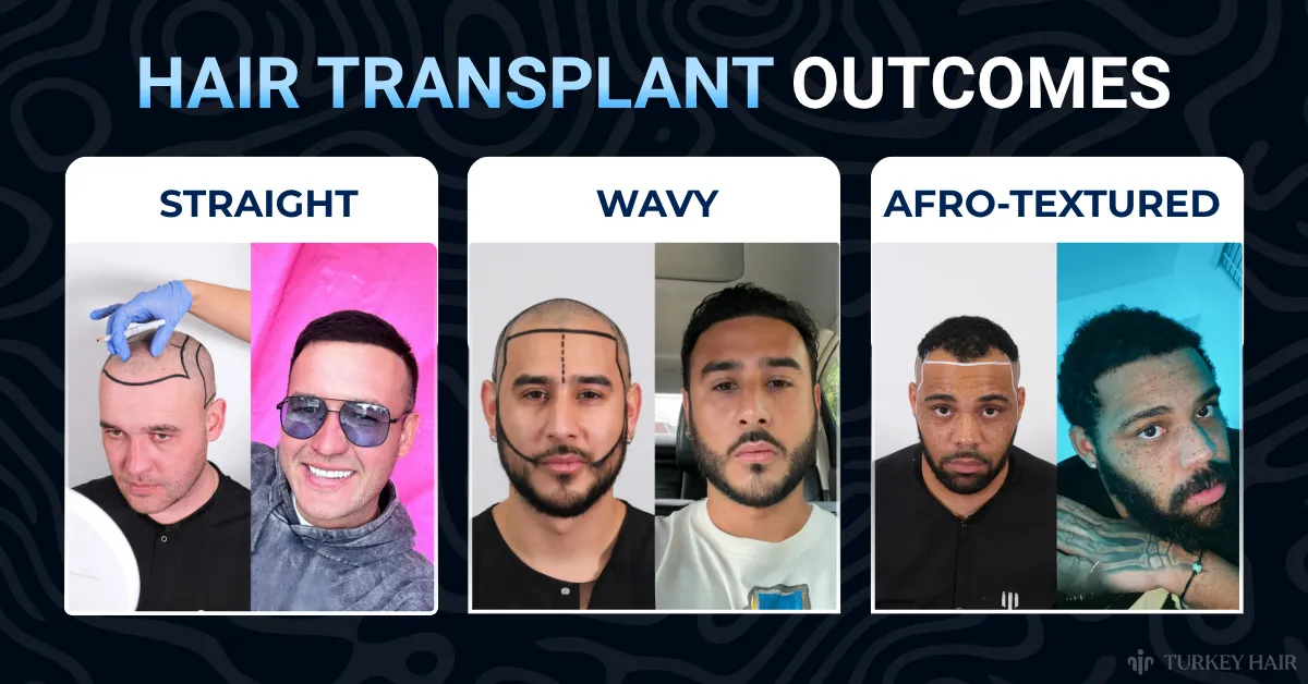 hair transplant aftercare, hair care after hair transplant, hair transplant recovery