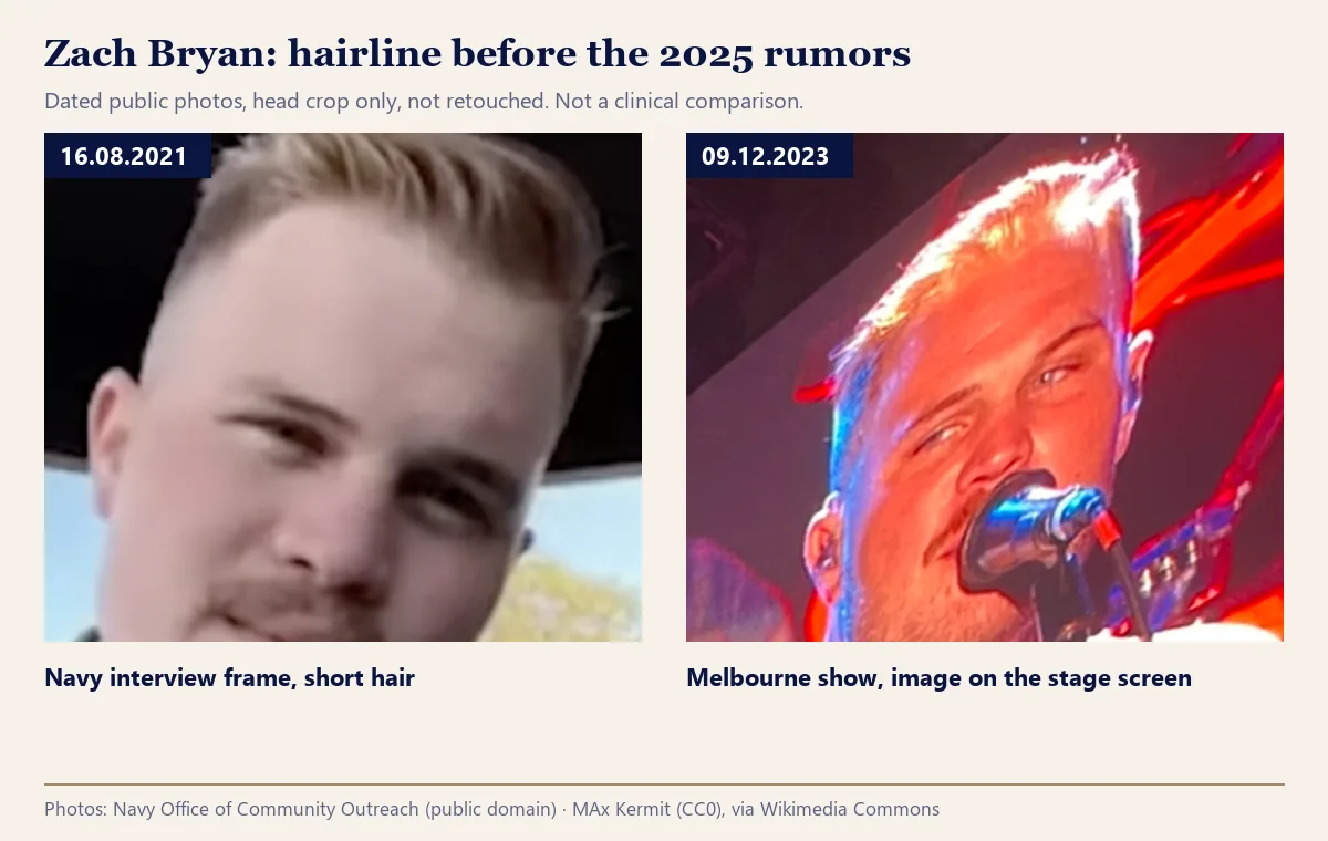 Zach Bryan hairline in dated photos from 16.08.2021 and 09.12.2023, before the 2025 rumors
