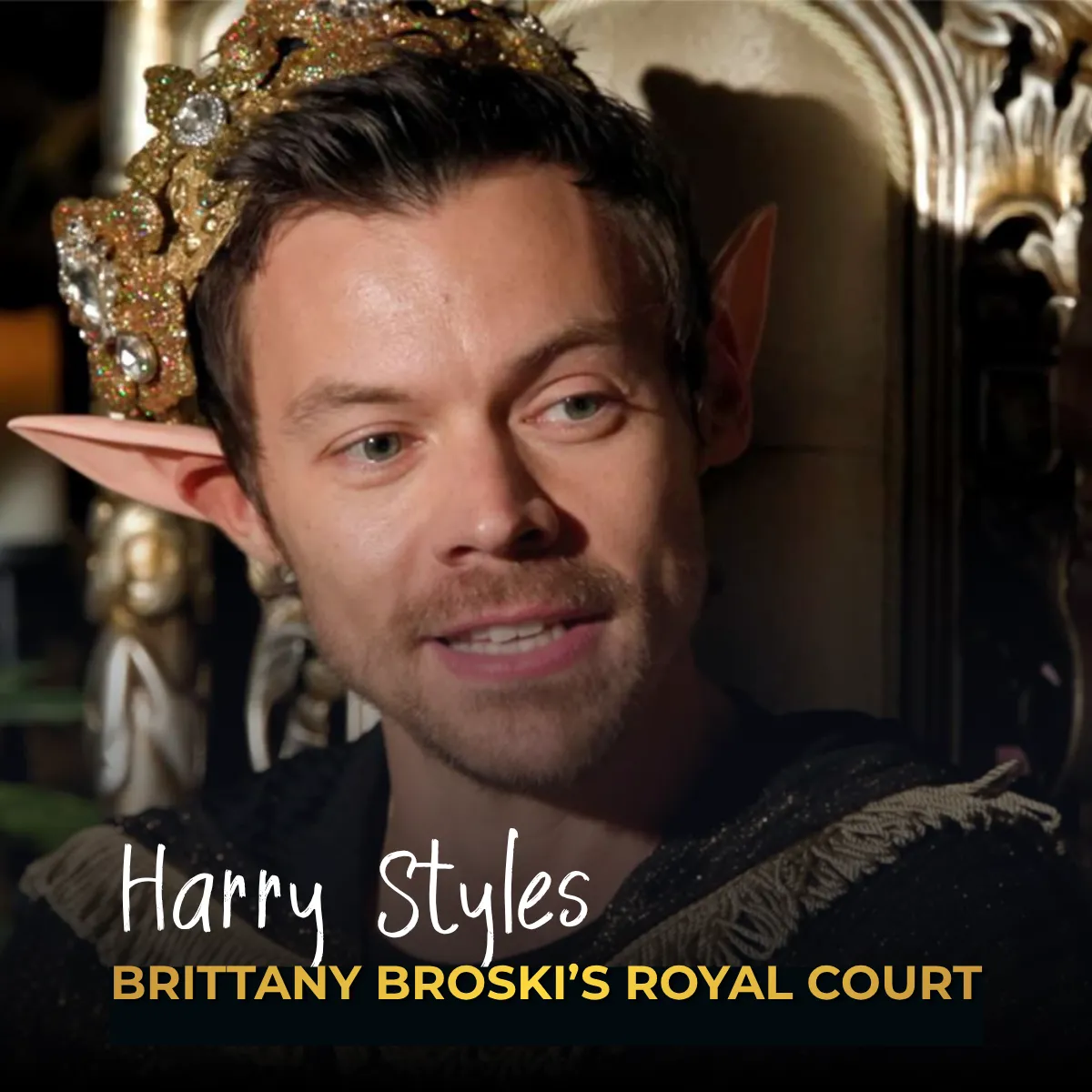 Harry Styles Hair Transplant: Rumors, Hairline & Photos