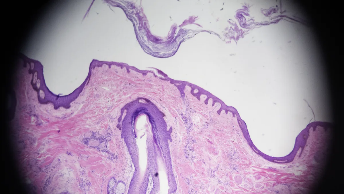 Stained micrograph of a scalp cross-section showing a hair follicle running down from the skin surface into the dermis
