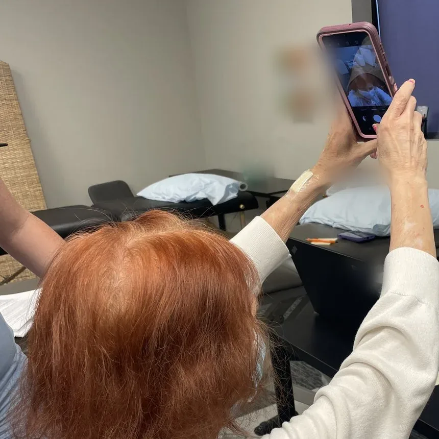 A person holding a phone above another person's head to take a picture of the scalp