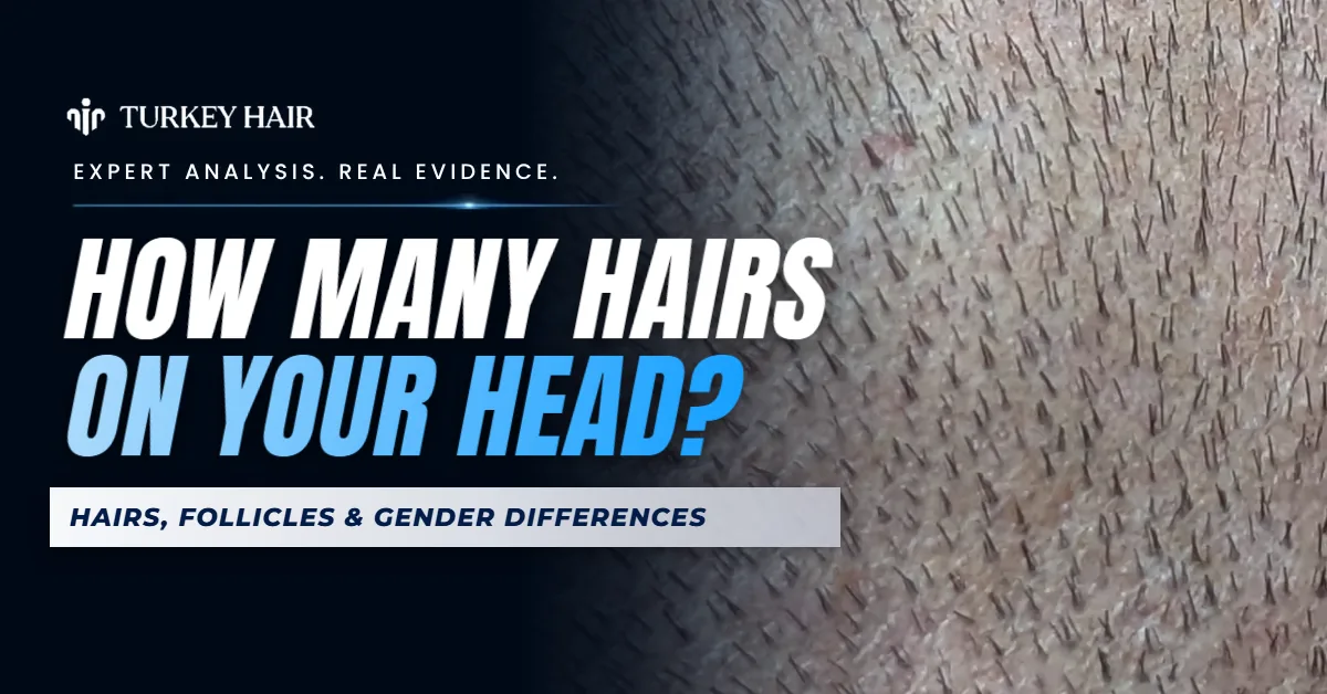 How Many Hairs Are on the Human Head: Hairs, Follicles and hair transplant analysis