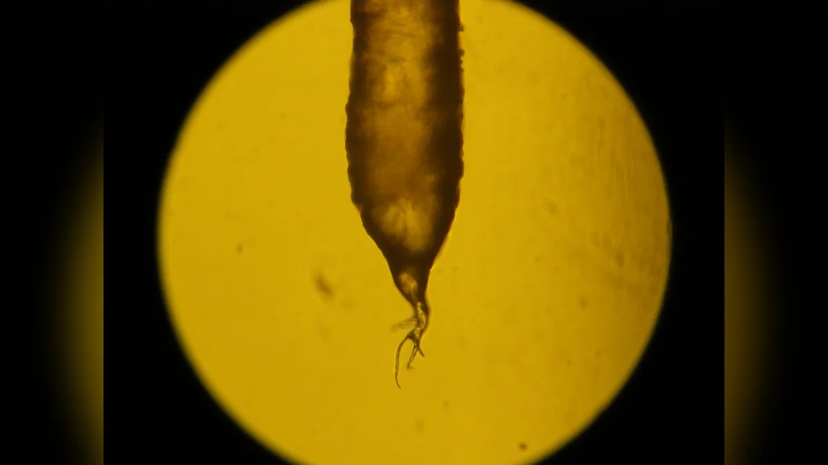 Root end of a black human hair seen under a light microscope