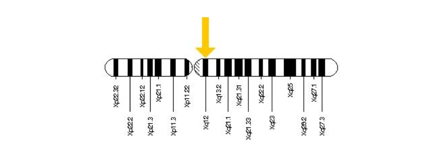 Diagram of the X chromosome with an arrow marking band Xq12, where the androgen receptor (AR) gene sits