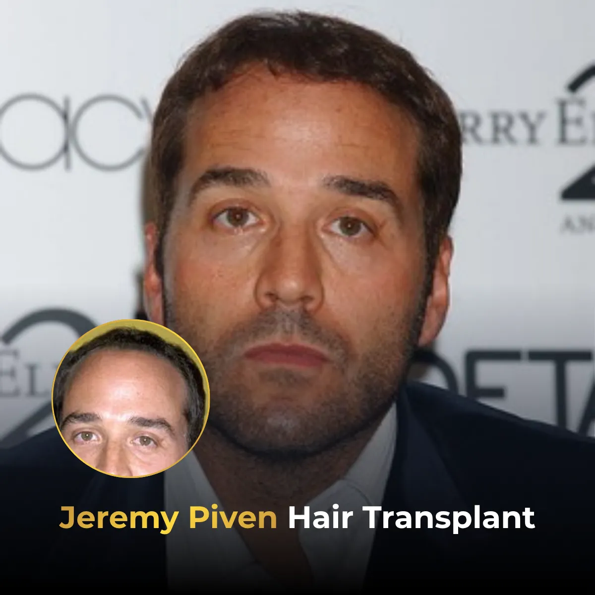 Jeremy Piven Hair Transplant: Before & After Photos, Hairline Analysis & Rumors Explained
