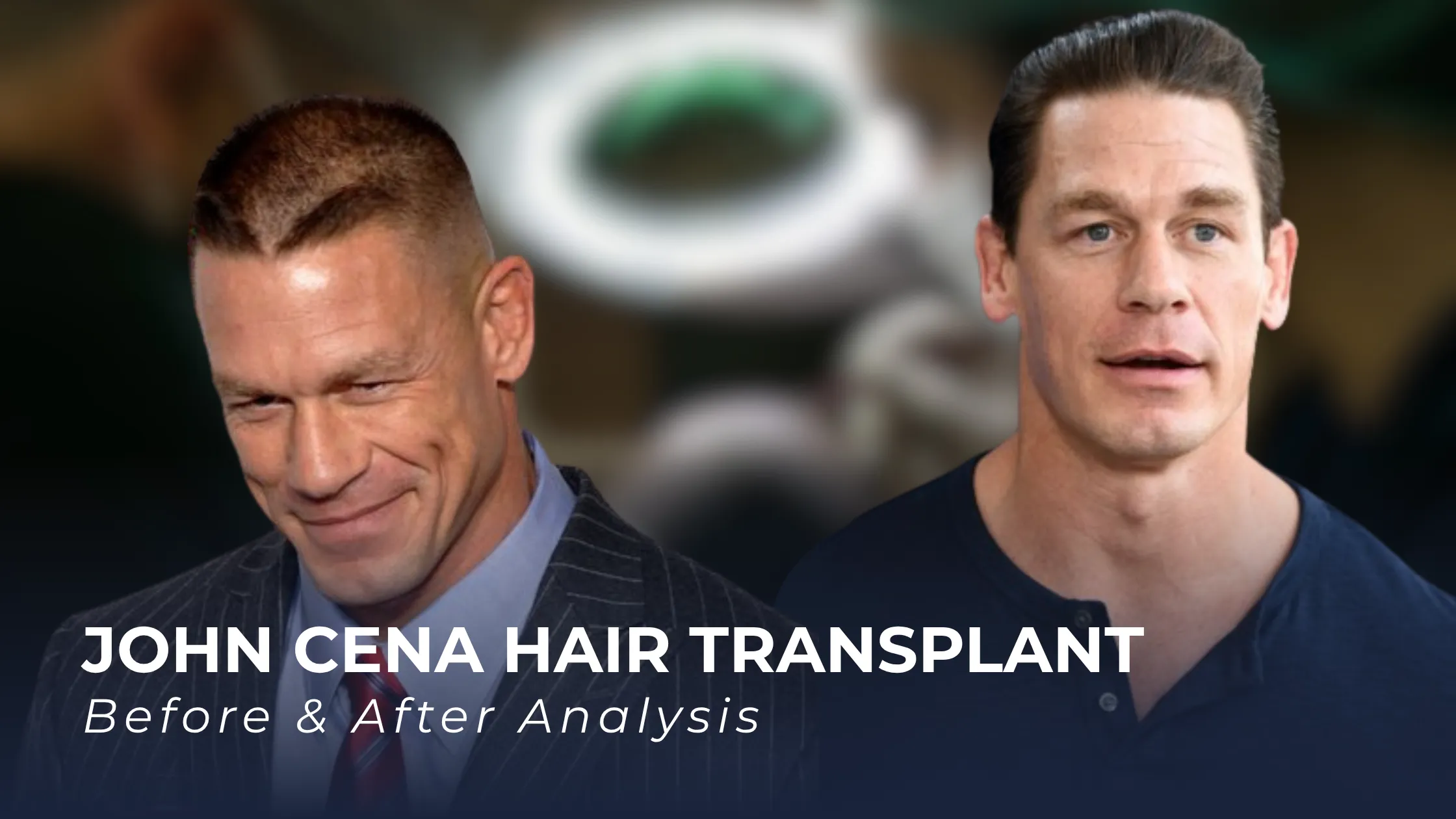 John Cena hair transplant before after, John Cena hairline analysis, John Cena hair restoration, celebrity hair transplant, hair loss transformation, hair transplant results