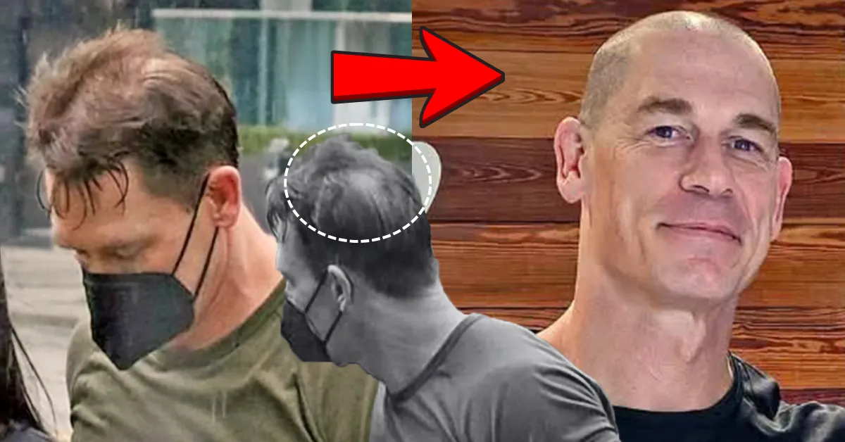 John Cena Hair Transplant: Confirmed Timeline, Before & After Photos, Crown Analysis