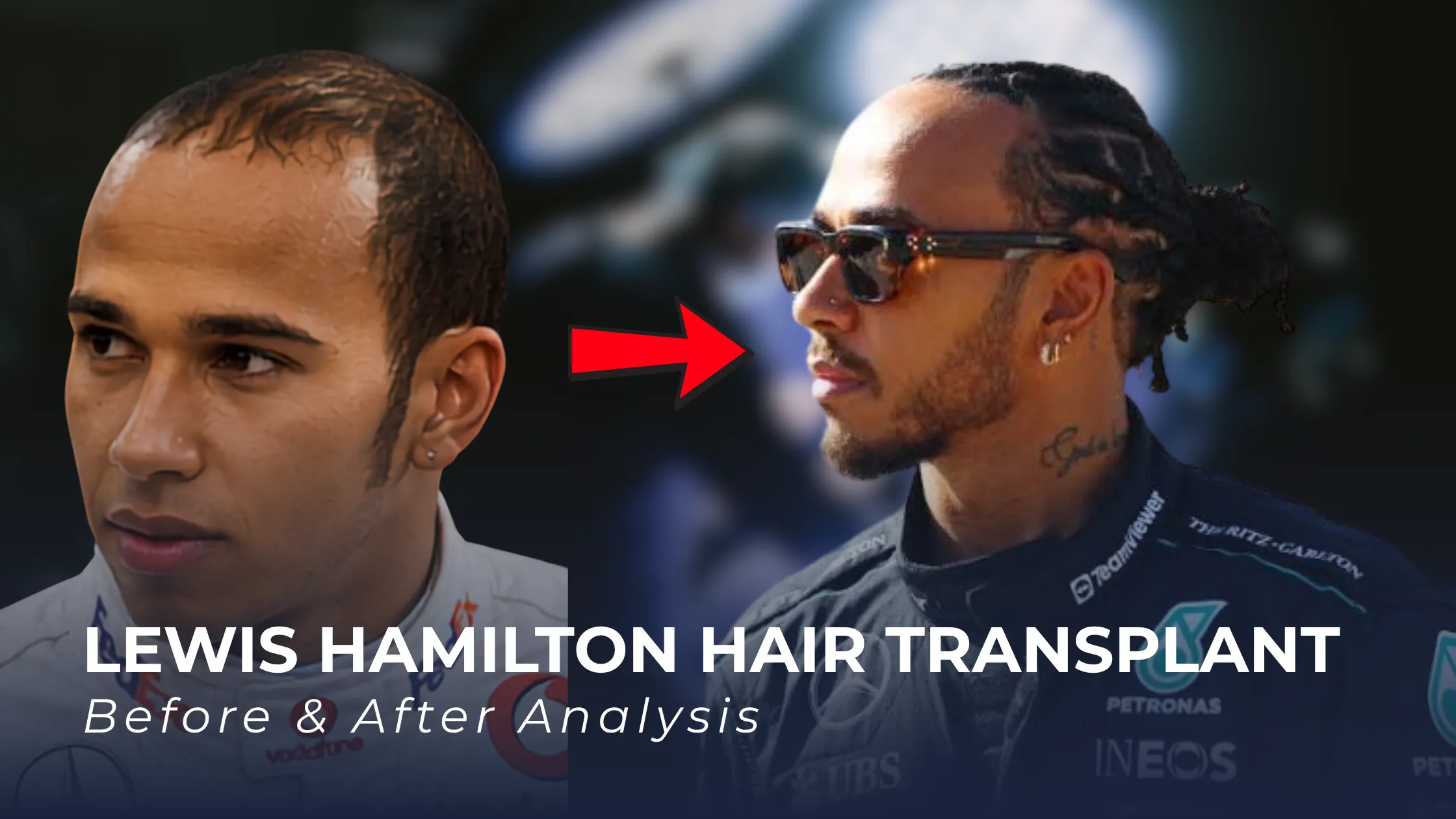 Jeremy Piven hair transplant, Jeremy Piven before after, Jeremy Piven hairline transformation, celebrity hair restoration, hair transplant rumors, Hair Club speculation